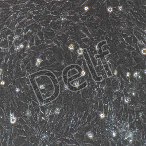 小鼠原代膀胱基質(zhì)成纖維細胞