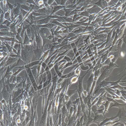 小鼠肺成纖維細(xì)胞永生化