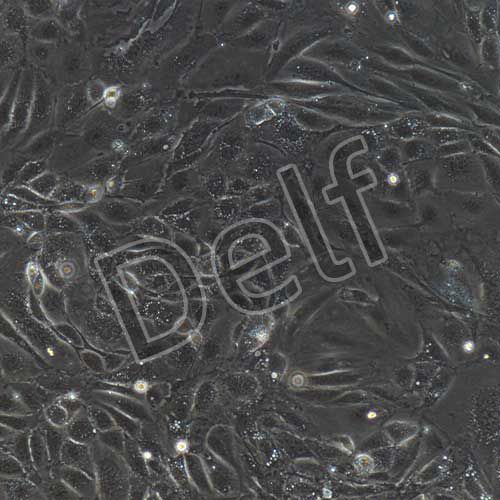 小鼠原代肺動(dòng)脈內(nèi)皮細(xì)胞