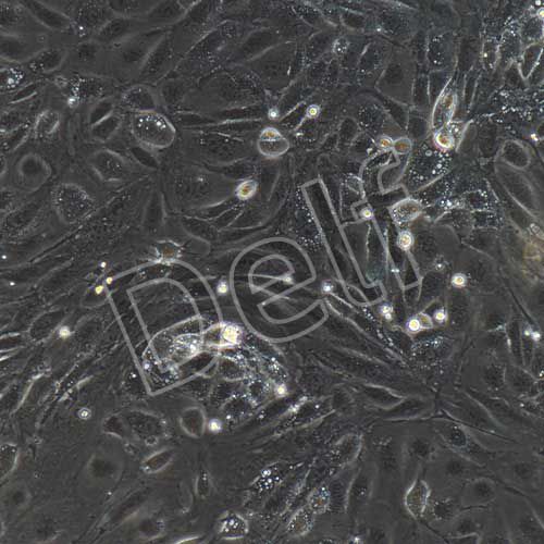 小鼠原代肺動(dòng)脈內(nèi)皮細(xì)胞