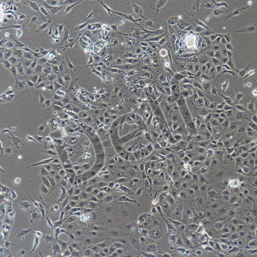 小鼠原代冠狀動脈內(nèi)皮細(xì)胞