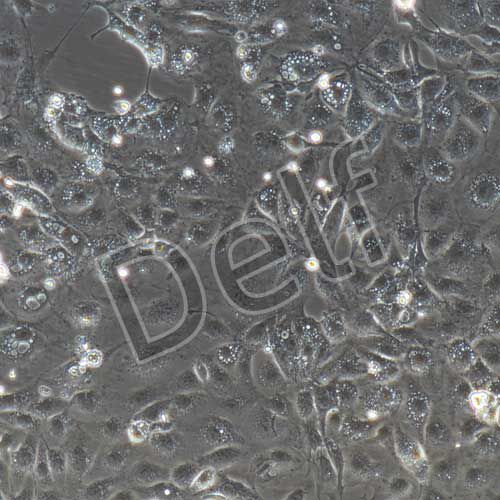 小鼠原代冠狀動脈內(nèi)皮細(xì)胞