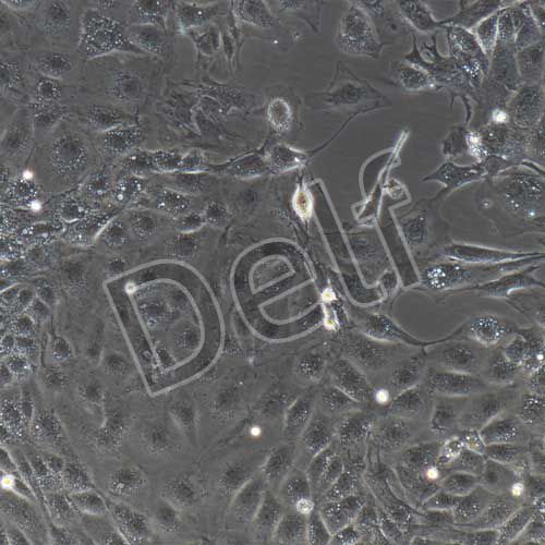 小鼠原代冠狀動脈內(nèi)皮細(xì)胞