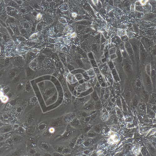 小鼠原代淋巴管內(nèi)皮細(xì)胞