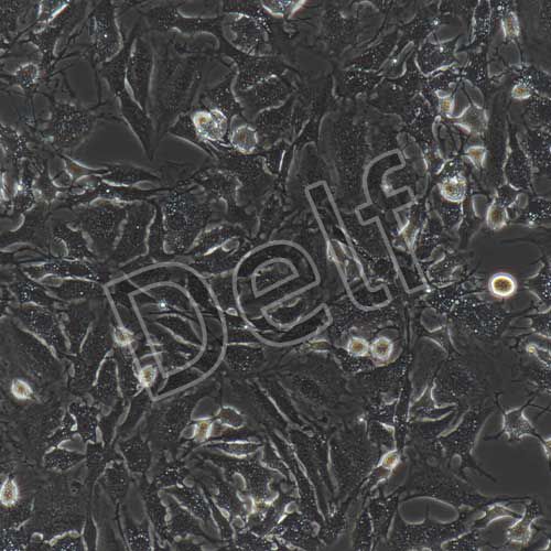 小鼠內(nèi)皮祖細胞永生化