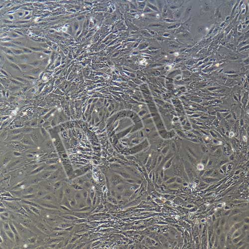 小鼠原代腎小球內(nèi)皮細(xì)胞