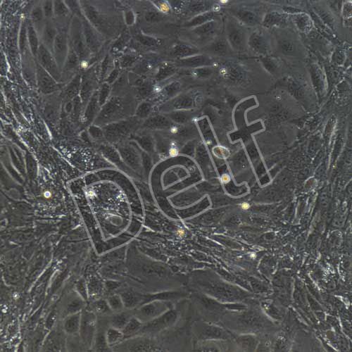 小鼠原代腎小球內(nèi)皮細(xì)胞