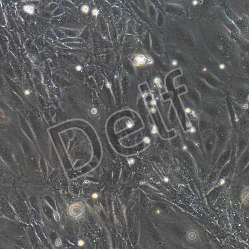 小鼠原代腎小球內(nèi)皮細(xì)胞