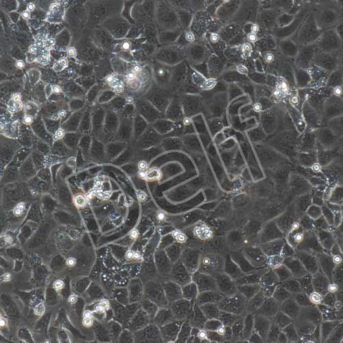 小鼠原代視網膜微血管內皮細胞