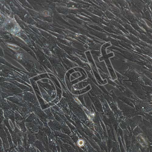 小鼠原代主動(dòng)脈弓平滑肌細(xì)胞