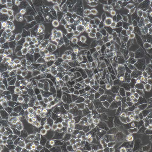 A2780+GFP 人卵巢癌細(xì)胞+GFP