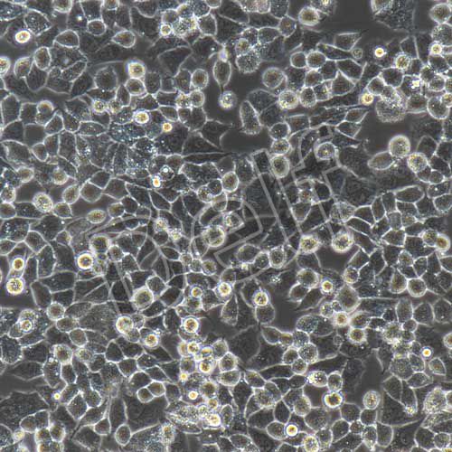 A2780+GFP 人卵巢癌細(xì)胞+GFP