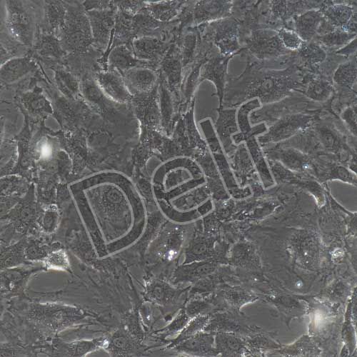 HUVEC+GFP 人臍靜脈內(nèi)皮細(xì)胞永生化+GFP