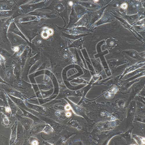 MDA-MB-231+GFP 人乳腺癌細(xì)胞+GFP