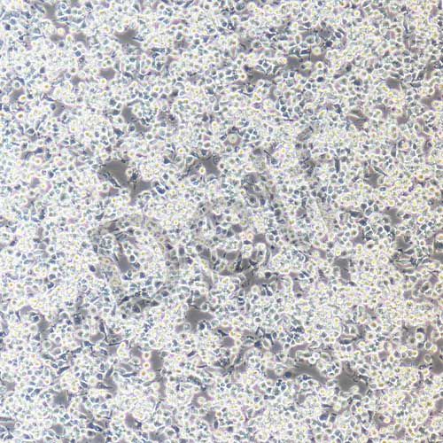 RAW264.7+GFP 小鼠單核巨噬細(xì)胞白血病細(xì)胞綠色熒光標(biāo)記