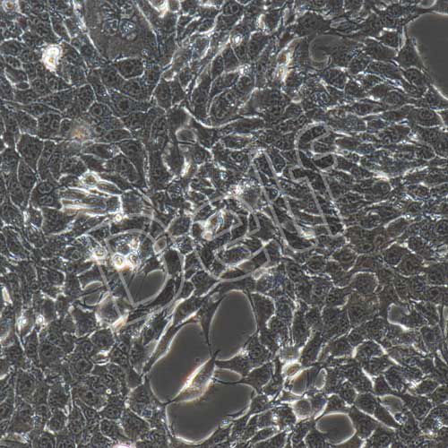 4T1-luc 小鼠乳腺癌細(xì)胞熒光素酶標(biāo)記