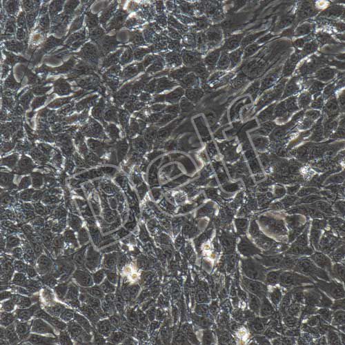 4T1-luc 小鼠乳腺癌細(xì)胞熒光素酶標(biāo)記