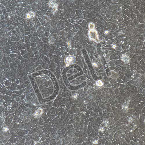 HaCat+luc 人永生化表皮細(xì)胞熒光素酶標(biāo)記