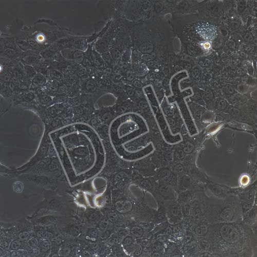 HCC827+luc 人非小細(xì)胞肺癌細(xì)胞熒光素酶標(biāo)記