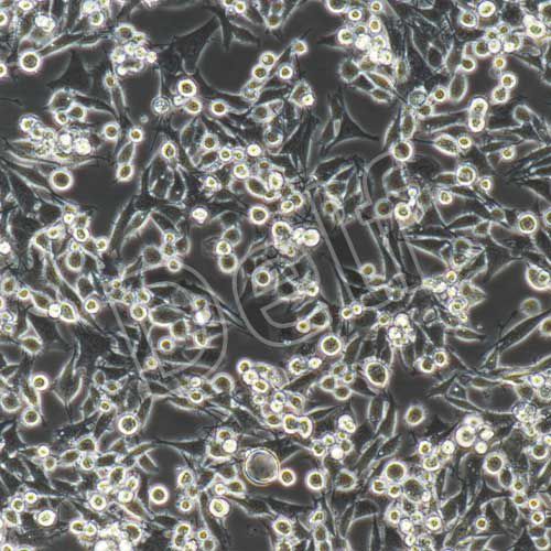 MB49+luc 小鼠膀胱癌細胞穩(wěn)定表達熒光素酶