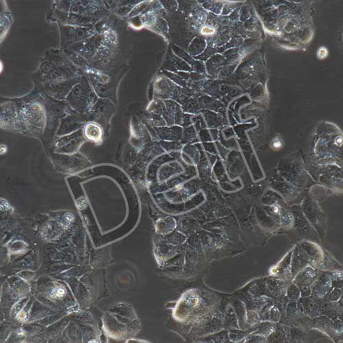 MCF-7+luc 人乳腺癌細胞+luc