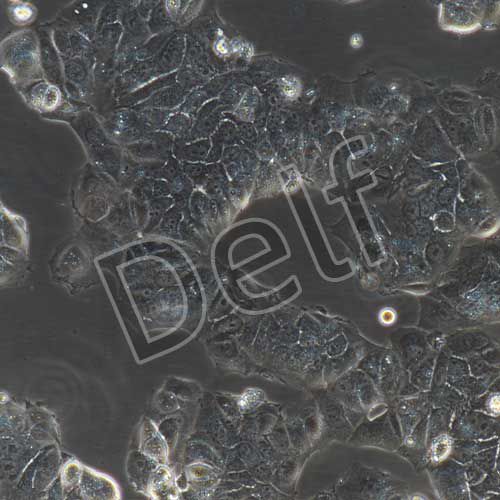 MCF-7+luc 人乳腺癌細胞+luc