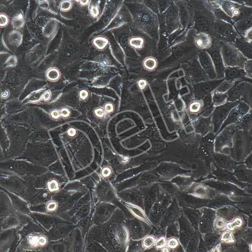 MDA-MB-231+luc 人乳腺癌細胞+luc