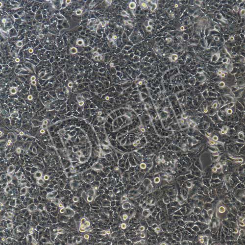 MHCC-97H+luc 人高轉(zhuǎn)移潛能肝癌細(xì)胞熒光素酶標(biāo)記