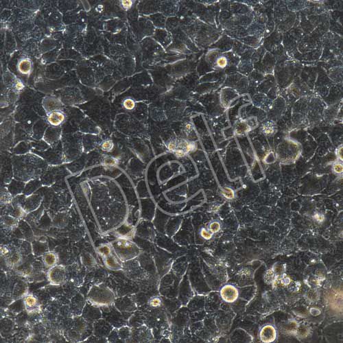 MHCC-97H+luc 人高轉(zhuǎn)移潛能肝癌細(xì)胞熒光素酶標(biāo)記