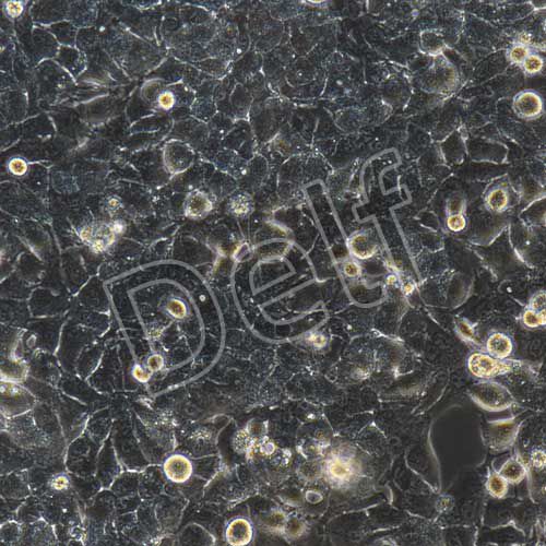 MHCC-97H+luc 人高轉(zhuǎn)移潛能肝癌細(xì)胞熒光素酶標(biāo)記