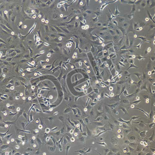 SK-OV-3+luc 人卵巢癌細胞熒光素酶標(biāo)記