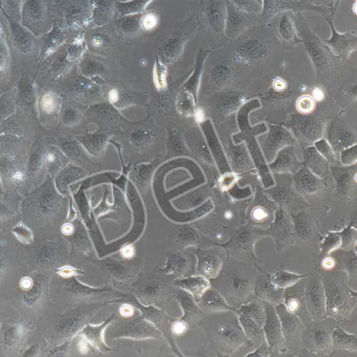 SK-OV-3+luc 人卵巢癌細胞熒光素酶標(biāo)記