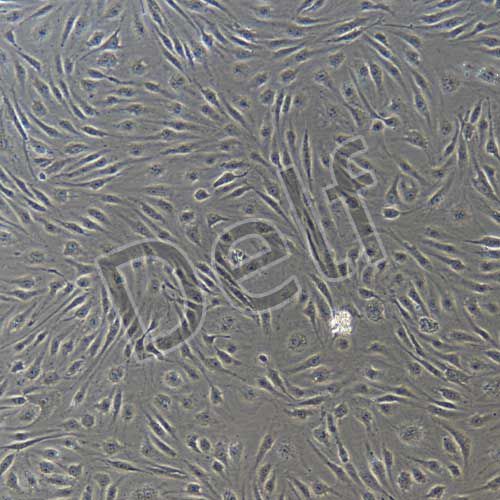 HUVEC+RFP 人臍靜脈內(nèi)皮細(xì)胞永生化+RFP