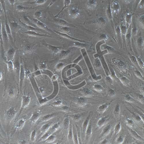 HUVEC+RFP 人臍靜脈內(nèi)皮細(xì)胞永生化+RFP