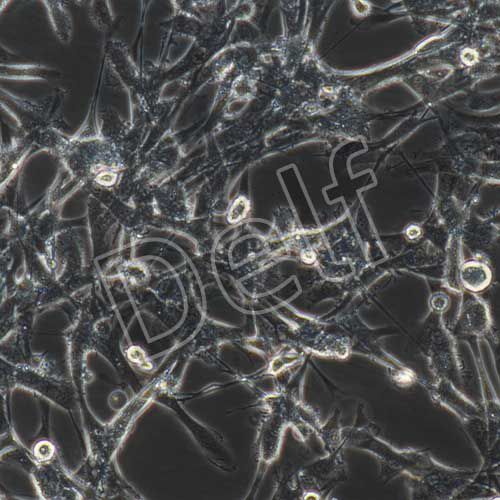 U87MG+RFP 人腦星形膠質(zhì)母細(xì)胞瘤+RFP