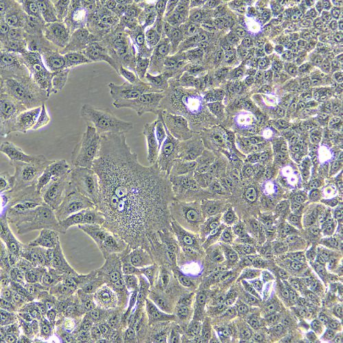 A549 人肺癌細(xì)胞