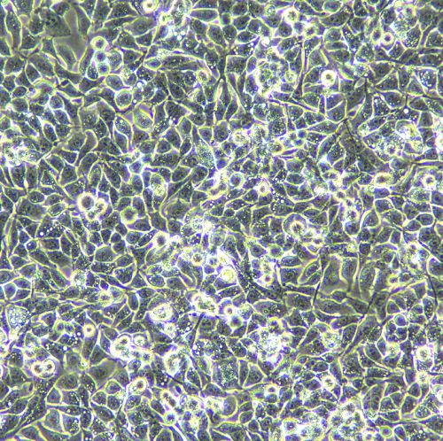 SMMC-7721 人肝癌細(xì)胞