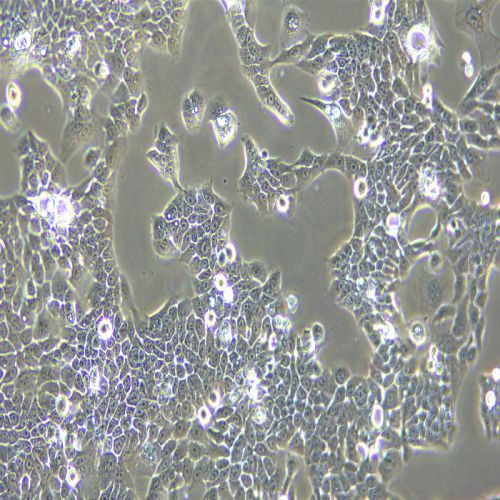 CAL33人舌磷癌細胞