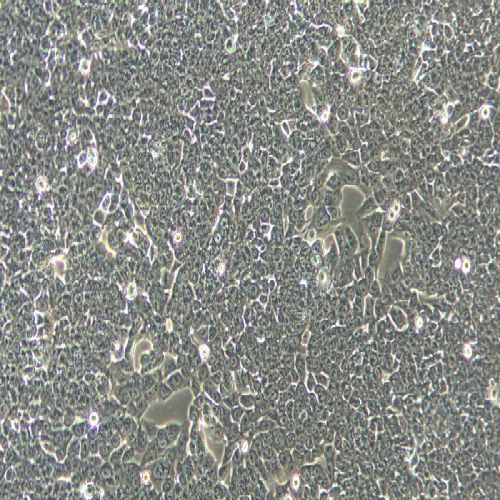 HCT116+luc 人結(jié)腸癌細(xì)胞熒光素酶標(biāo)記