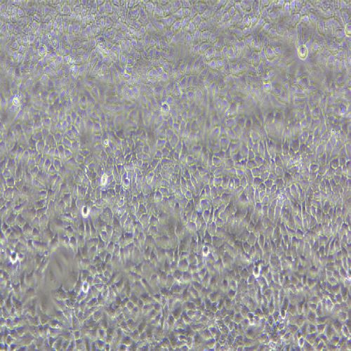 NCI-H292 人肺癌細胞(淋巴結轉移)