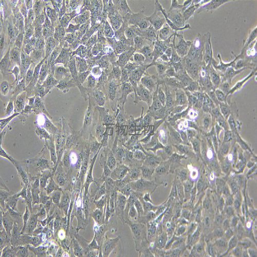 12Z人子宮內(nèi)膜異位癥細(xì)胞