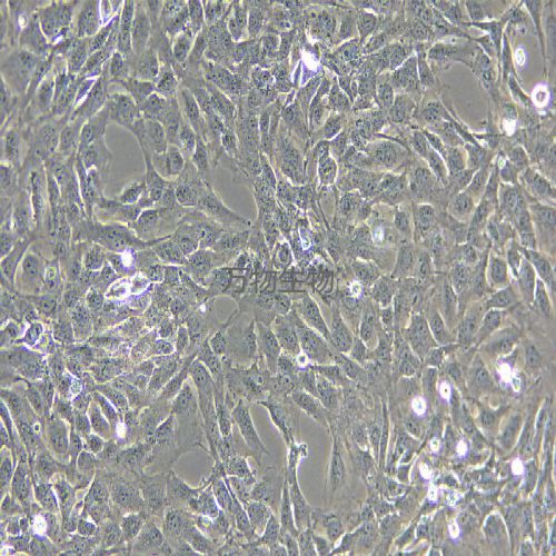 12Z人子宮內(nèi)膜異位癥細(xì)胞