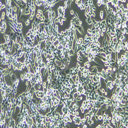 LLC 小鼠Lewis肺癌細(xì)胞