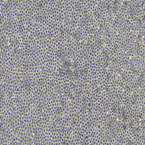 KG-1 人急性骨髓性白血病細胞
