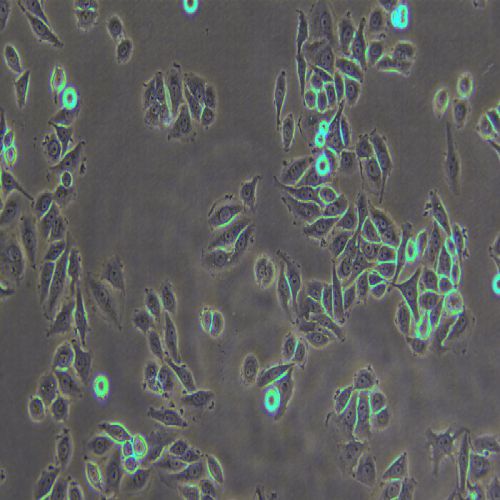 SiHa 人子宮頸鱗癌細(xì)胞