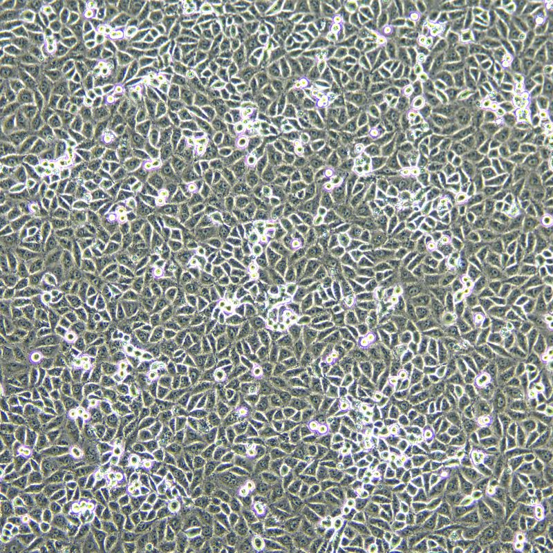 A549/DDP 人肺癌細(xì)胞（A549順鉑耐藥株）