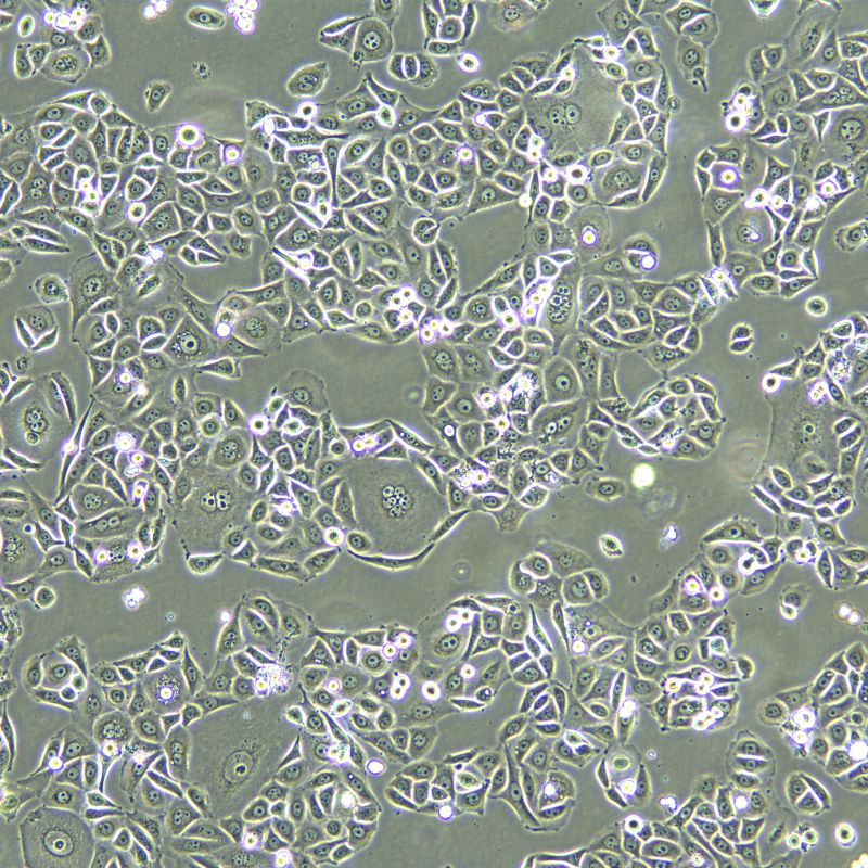 PC-9 人肺癌細(xì)胞奧西替尼耐藥株