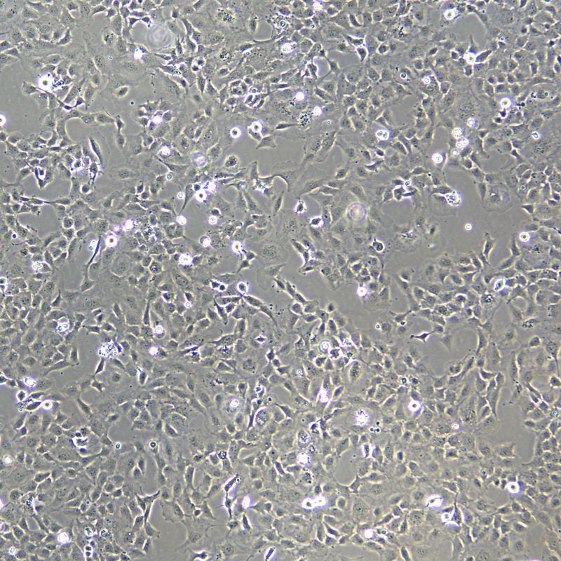 HMEC-1 人微血管內(nèi)皮細胞株