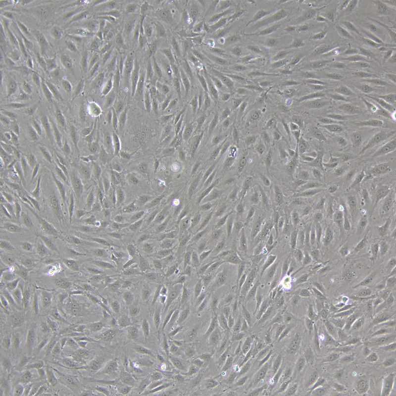 人原代冠狀動脈內(nèi)皮細胞