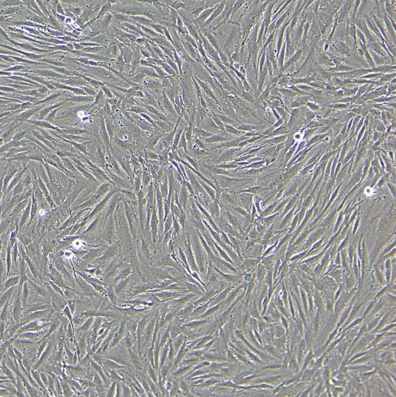 KGN 人卵巢顆粒細(xì)胞瘤細(xì)胞